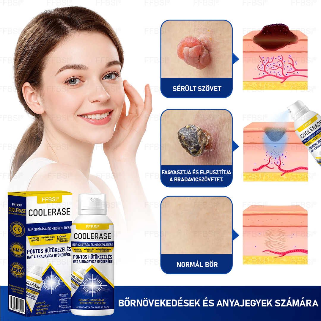 FFBSI® CoolErase Bőrregeneráló Spray (Szemölcsök, Hólyagok, Ekcéma, Pikkelysömör, Bőrkinövések, Akne, Bőrcímkék, Hegek, Anyajegyek)