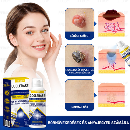 FFBSI® CoolErase Bőrregeneráló Spray (Szemölcsök, Hólyagok, Ekcéma, Pikkelysömör, Bőrkinövések, Akne, Bőrcímkék, Hegek, Anyajegyek)