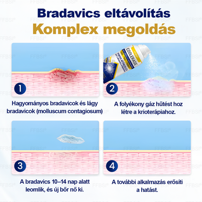 FFBSI® CoolErase Bőrregeneráló Spray (Szemölcsök, Hólyagok, Ekcéma, Pikkelysömör, Bőrkinövések, Akne, Bőrcímkék, Hegek, Anyajegyek)