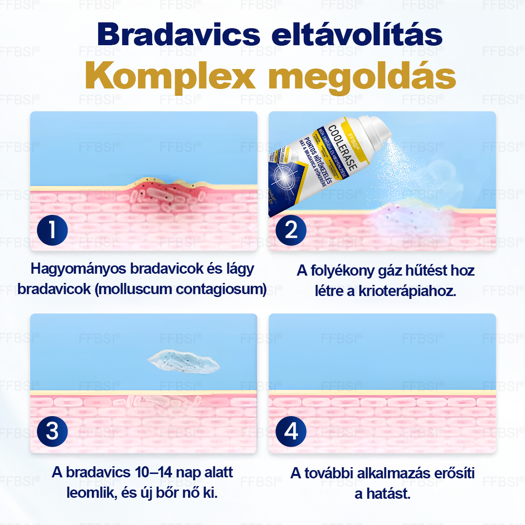 FFBSI® 🧊 CoolErase Bőrregeneráló Spray (Szemölcsök, Hólyagok, Ekcéma, Pikkelysömör, Bőrkinövések, Akne, Bőrcímkék, Hegek, Anyajegyek)