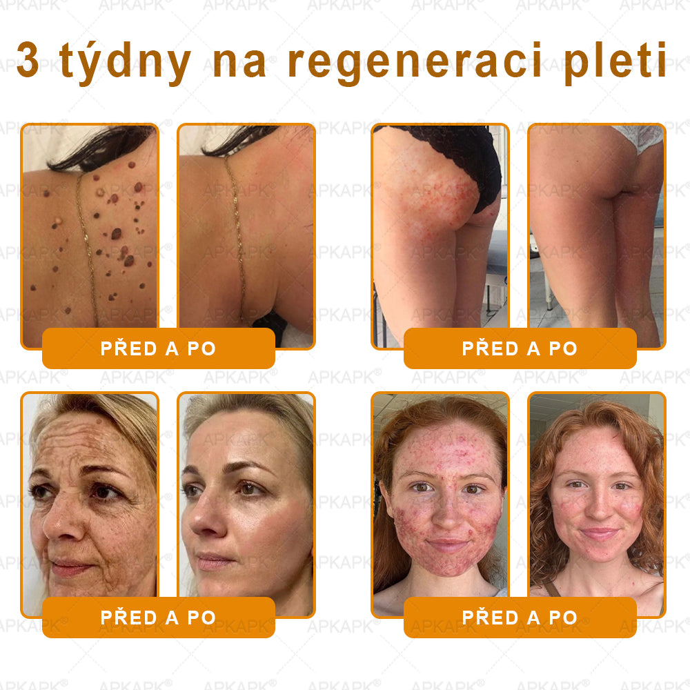 ⏰ Már csak néhány darab maradt raktáron! Használja ki a különleges –30% kedvezményt! ⏰ APKAPK®