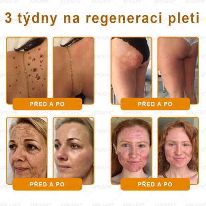 ⏰ Már csak néhány darab maradt raktáron! Használja ki a különleges –30% kedvezményt! ⏰ APKAPK®
