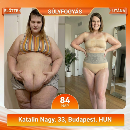 Hivatalos Márkabol🎈 ZUWIAY® 2026 Moringa & Berberine 4-in-1 Mikrorészecskés Alakformáló és Zsírégető Rövidnadrág