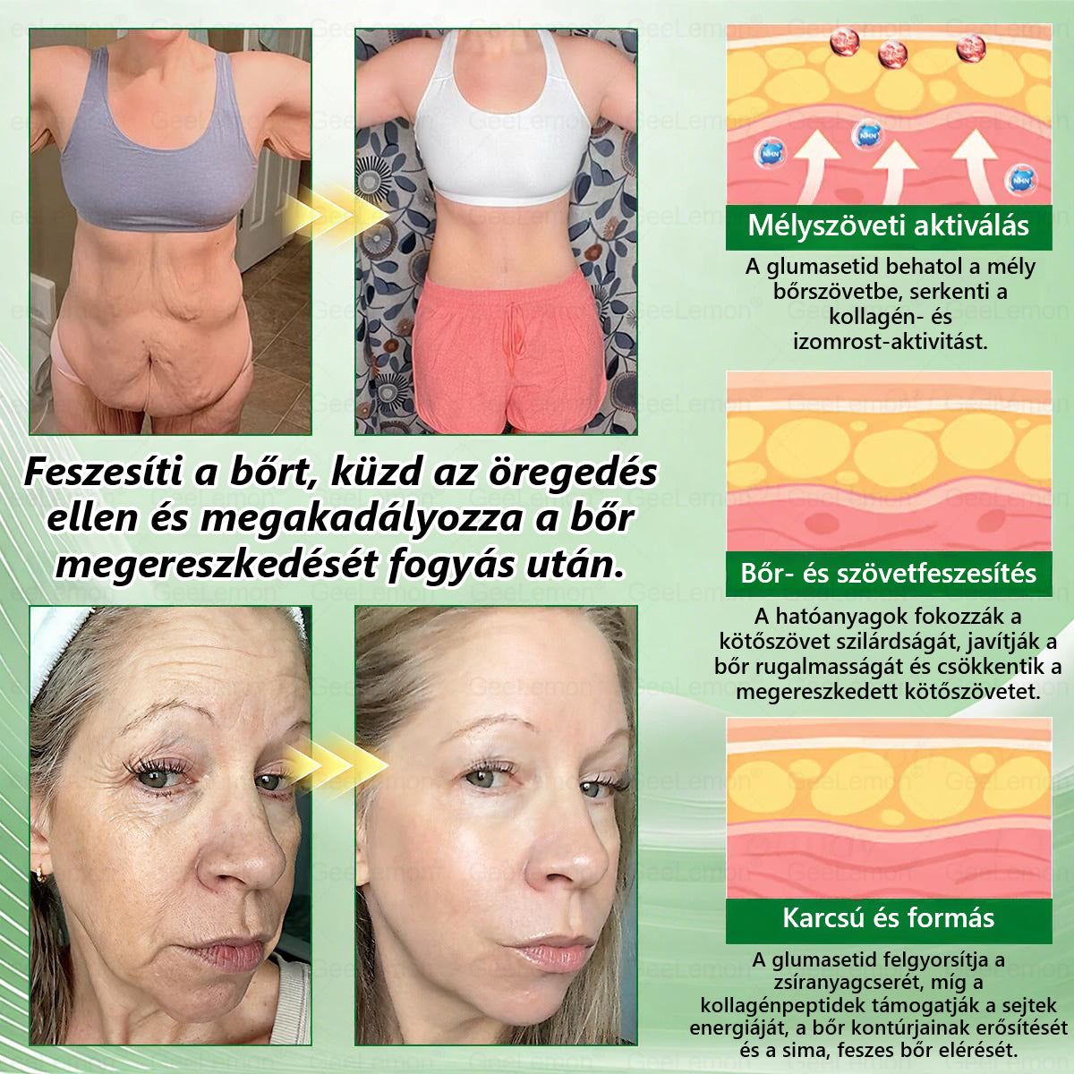 𝑮𝐞𝐞𝑳𝐞𝒎𝒐𝒏® 👩‍⚕️ 10 az 1-ben karcsúsító nano mikrotűs tapasz (Napi egyszeri használat, látható változások 7 napon belül) Elhízás, szív- és érrendszeri egészség, cukorbetegség