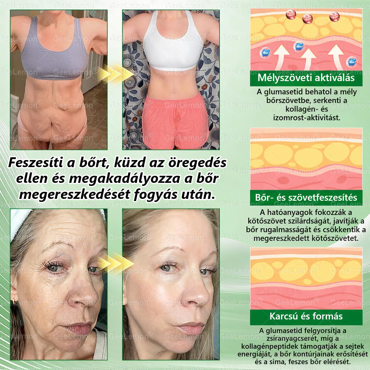𝐆𝐞𝑒𝐿𝑒𝐦𝐨𝐧® 👩‍⚕️ Glumasetide 8 az 1-ben Karcsú és Egészséges Nano Mikrotűs Tapasz