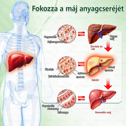 𝑮𝐞𝐞𝑳𝐞𝒎𝒐𝒏® 👩‍⚕️ 10 az 1-ben karcsúsító nano mikrotűs tapasz (Napi egyszeri használat, látható változások 7 napon belül) Elhízás, szív- és érrendszeri egészség, cukorbetegség