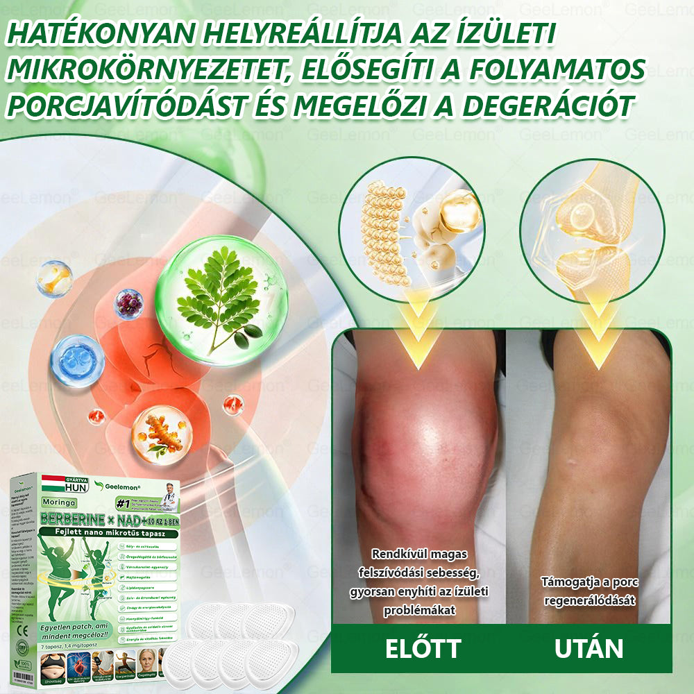𝑮𝐞𝐞𝑳𝐞𝒎𝒐𝒏® 👩‍⚕️ 10 az 1-ben karcsúsító nano mikrotűs tapasz (Napi egyszeri használat, látható változások 7 napon belül) Elhízás, szív- és érrendszeri egészség, cukorbetegség