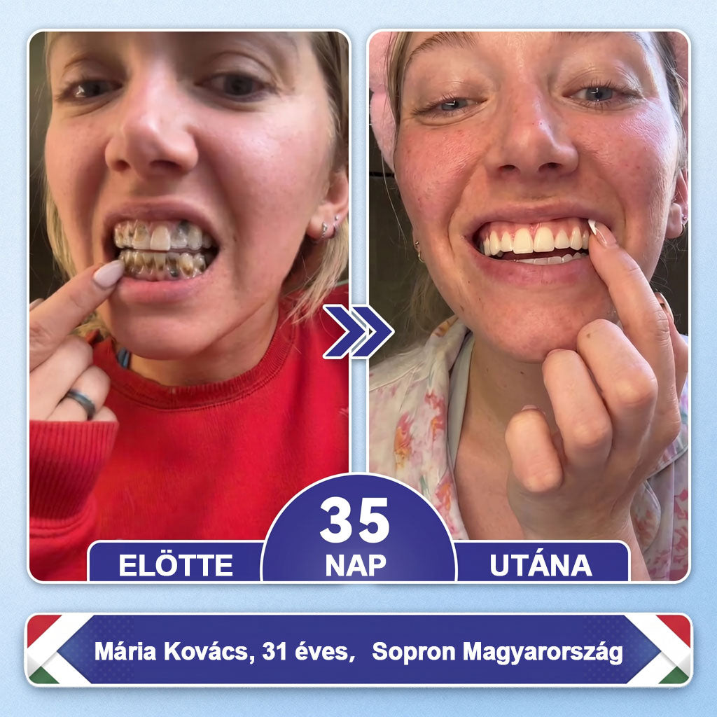 🦷HAJUEI® Tideglusib Fog & íny Javító mikrotűs tapasz | Fejlett őssejt-aktiváló fogcsíkok (újjáépíti a fogzománcot és a dentint • erősíti az ínyt • megszünteti a fogkövet és a szagokat • megállítja a fogérzékenységet)