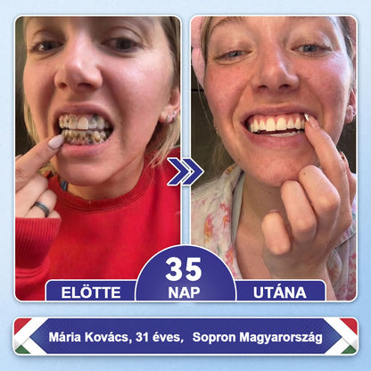 🦷HAJUEI® Tideglusib Fog & íny Javító mikrotűs tapasz | Fejlett őssejt-aktiváló fogcsíkok (újjáépíti a fogzománcot és a dentint • erősíti az ínyt • megszünteti a fogkövet és a szagokat • megállítja a fogérzékenységet)