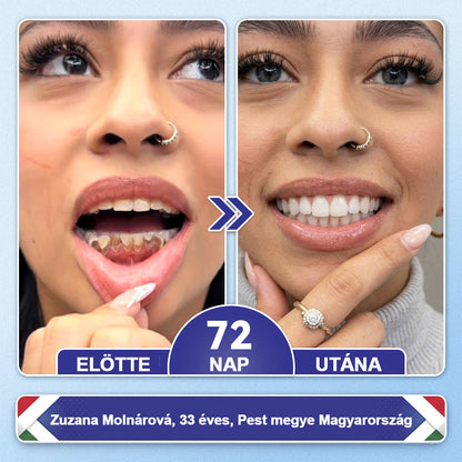 🦷HAJUEI® Tideglusib Fog & íny Javító mikrotűs tapasz | Fejlett őssejt-aktiváló fogcsíkok (újjáépíti a fogzománcot és a dentint • erősíti az ínyt • megszünteti a fogkövet és a szagokat • megállítja a fogérzékenységet)