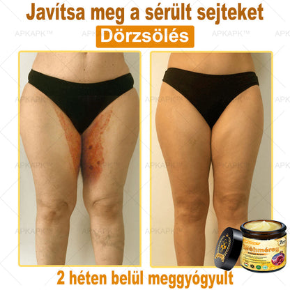 APKAPK®  Méhméreg krém a bőr megújítására 🐝 segít megoldani olyan bőrproblémákat, mint: ráncok, hegek, pigmentfoltok, striák, akné, pikkelysömör, ekcéma, bőrelváltozások, irritációk, gyulladások és egyéb bőrpanaszok.