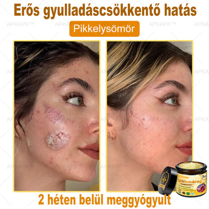 APKAPK®  Méhméreg krém a bőr megújítására 🐝 segít megoldani olyan bőrproblémákat, mint: ráncok, hegek, pigmentfoltok, striák, akné, pikkelysömör, ekcéma, bőrelváltozások, irritációk, gyulladások és egyéb bőrpanaszok.