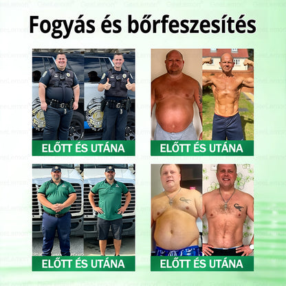 𝑮𝐞𝐞𝑳𝐞𝒎𝒐𝒏® 👩‍⚕️ 10 az 1-ben karcsúsító nano mikrotűs tapasz (Napi egyszeri használat, látható változások 7 napon belül) Elhízás, szív- és érrendszeri egészség, cukorbetegség