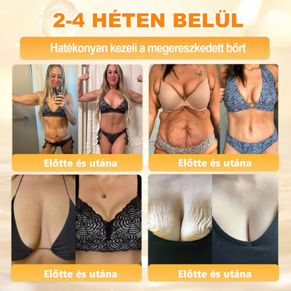APKAPK®  Méhméreg krém a bőr megújítására 🐝 segít megoldani olyan bőrproblémákat, mint: ráncok, hegek, pigmentfoltok, striák, akné, pikkelysömör, ekcéma, bőrelváltozások, irritációk, gyulladások és egyéb bőrpanaszok.