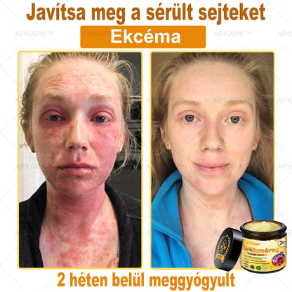 APKAPK®  Méhméreg krém a bőr megújítására 🐝 segít megoldani olyan bőrproblémákat, mint: ráncok, hegek, pigmentfoltok, striák, akné, pikkelysömör, ekcéma, bőrelváltozások, irritációk, gyulladások és egyéb bőrpanaszok.