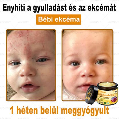 APKAPK®  Méhméreg krém a bőr megújítására 🐝 segít megoldani olyan bőrproblémákat, mint: ráncok, hegek, pigmentfoltok, striák, akné, pikkelysömör, ekcéma, bőrelváltozások, irritációk, gyulladások és egyéb bőrpanaszok.