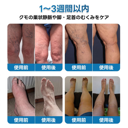 🇯🇵🏆✅️🏃 HAJUEI® VeinRepair マイクロニードルパッチロール ⚡ すばやくケア、効果を長くキープ