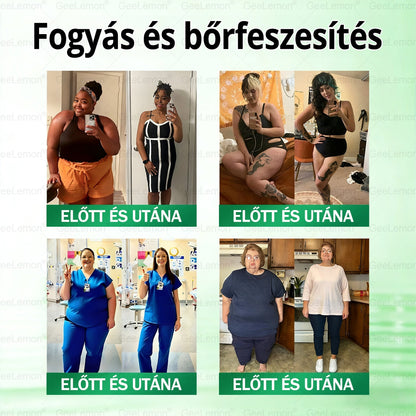 𝐆𝐞𝑒𝐿𝑒𝐦𝐨𝐧® 👩‍⚕️ Glumasetide 8 az 1-ben Karcsú és Egészséges Nano Mikrotűs Tapasz