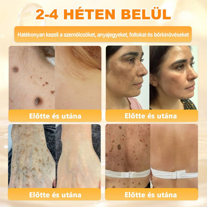 APKAPK®  Méhméreg krém a bőr megújítására 🐝 segít megoldani olyan bőrproblémákat, mint: ráncok, hegek, pigmentfoltok, striák, akné, pikkelysömör, ekcéma, bőrelváltozások, irritációk, gyulladások és egyéb bőrpanaszok.