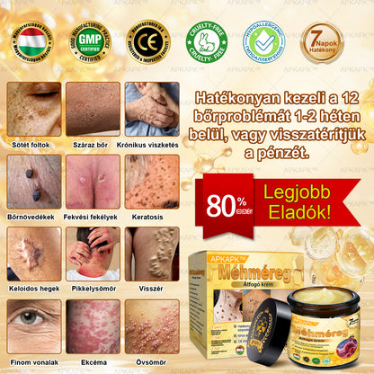 APKAPK®  Méhméreg krém a bőr megújítására 🐝 segít megoldani olyan bőrproblémákat, mint: ráncok, hegek, pigmentfoltok, striák, akné, pikkelysömör, ekcéma, bőrelváltozások, irritációk, gyulladások és egyéb bőrpanaszok.