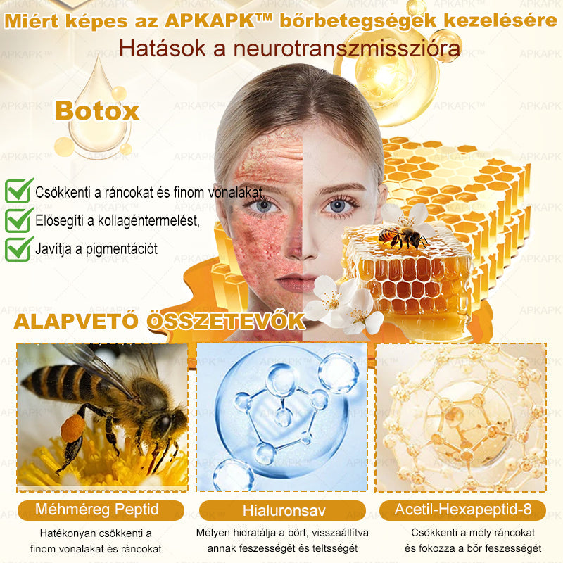 APKAPK®  Méhméreg krém a bőr megújítására 🐝 segít megoldani olyan bőrproblémákat, mint: ráncok, hegek, pigmentfoltok, striák, akné, pikkelysömör, ekcéma, bőrelváltozások, irritációk, gyulladások és egyéb bőrpanaszok.