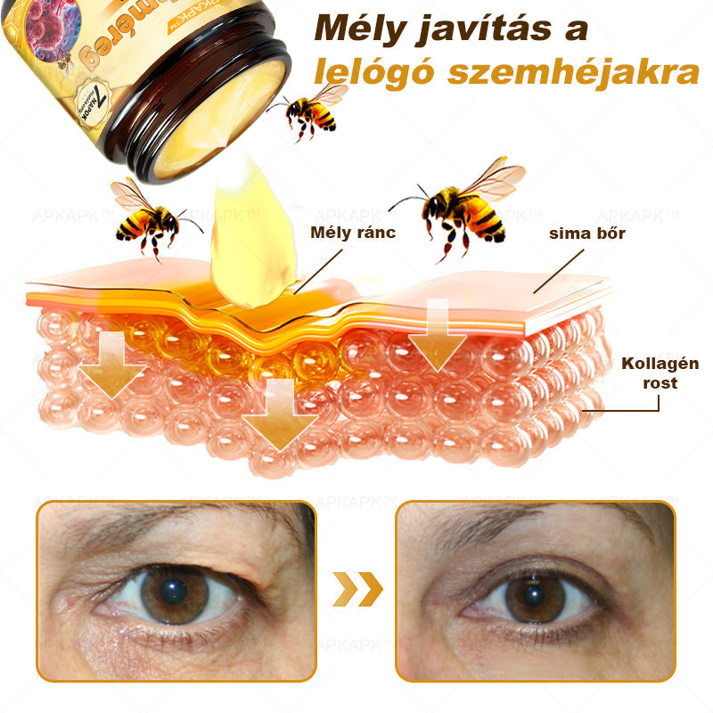 APKAPK®  Méhméreg krém a bőr megújítására 🐝 segít megoldani olyan bőrproblémákat, mint: ráncok, hegek, pigmentfoltok, striák, akné, pikkelysömör, ekcéma, bőrelváltozások, irritációk, gyulladások és egyéb bőrpanaszok.