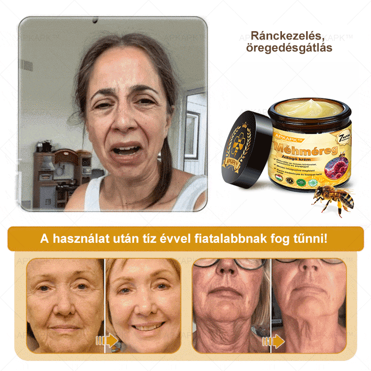 APKAPK®  Méhméreg krém a bőr megújítására 🐝 segít megoldani olyan bőrproblémákat, mint: ráncok, hegek, pigmentfoltok, striák, akné, pikkelysömör, ekcéma, bőrelváltozások, irritációk, gyulladások és egyéb bőrpanaszok.