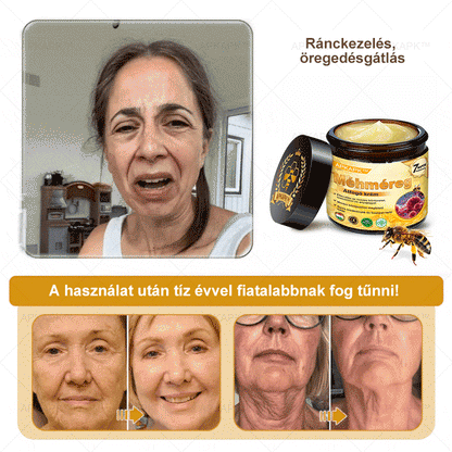 APKAPK®  Méhméreg krém a bőr megújítására 🐝 segít megoldani olyan bőrproblémákat, mint: ráncok, hegek, pigmentfoltok, striák, akné, pikkelysömör, ekcéma, bőrelváltozások, irritációk, gyulladások és egyéb bőrpanaszok.