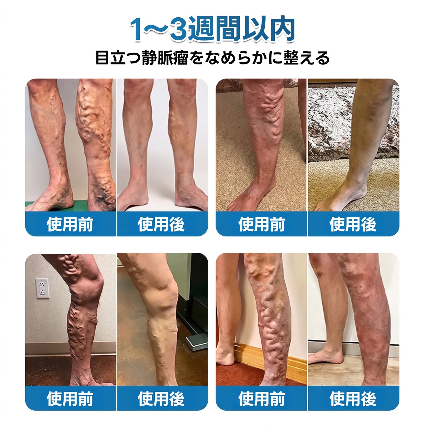🇯🇵🏆✅️🏃 HAJUEI® VeinRepair マイクロニードルパッチロール ⚡ すばやくケア、効果を長くキープ