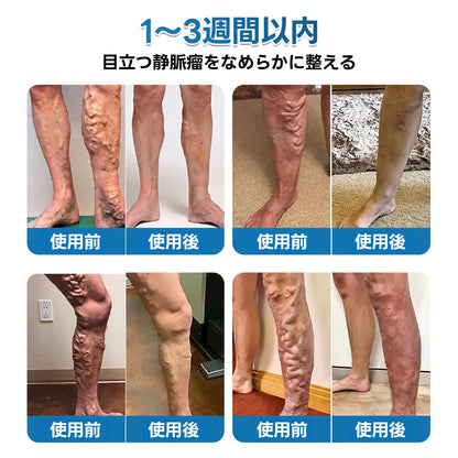 🇯🇵🏆✅️🏃 HAJUEI® VeinRepair マイクロニードルパッチロール ⚡ すばやくケア、効果を長くキープ