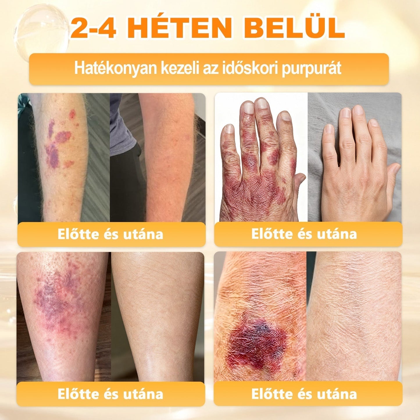 APKAPK®  Méhméreg krém a bőr megújítására 🐝 segít megoldani olyan bőrproblémákat, mint: ráncok, hegek, pigmentfoltok, striák, akné, pikkelysömör, ekcéma, bőrelváltozások, irritációk, gyulladások és egyéb bőrpanaszok.