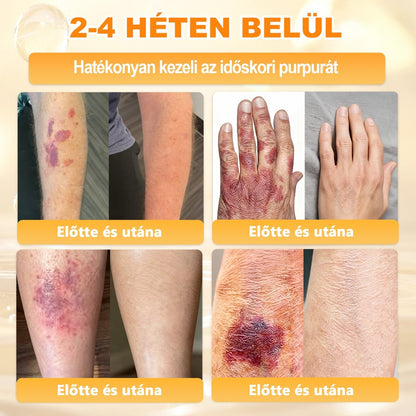 APKAPK®  Méhméreg krém a bőr megújítására 🐝 segít megoldani olyan bőrproblémákat, mint: ráncok, hegek, pigmentfoltok, striák, akné, pikkelysömör, ekcéma, bőrelváltozások, irritációk, gyulladások és egyéb bőrpanaszok.