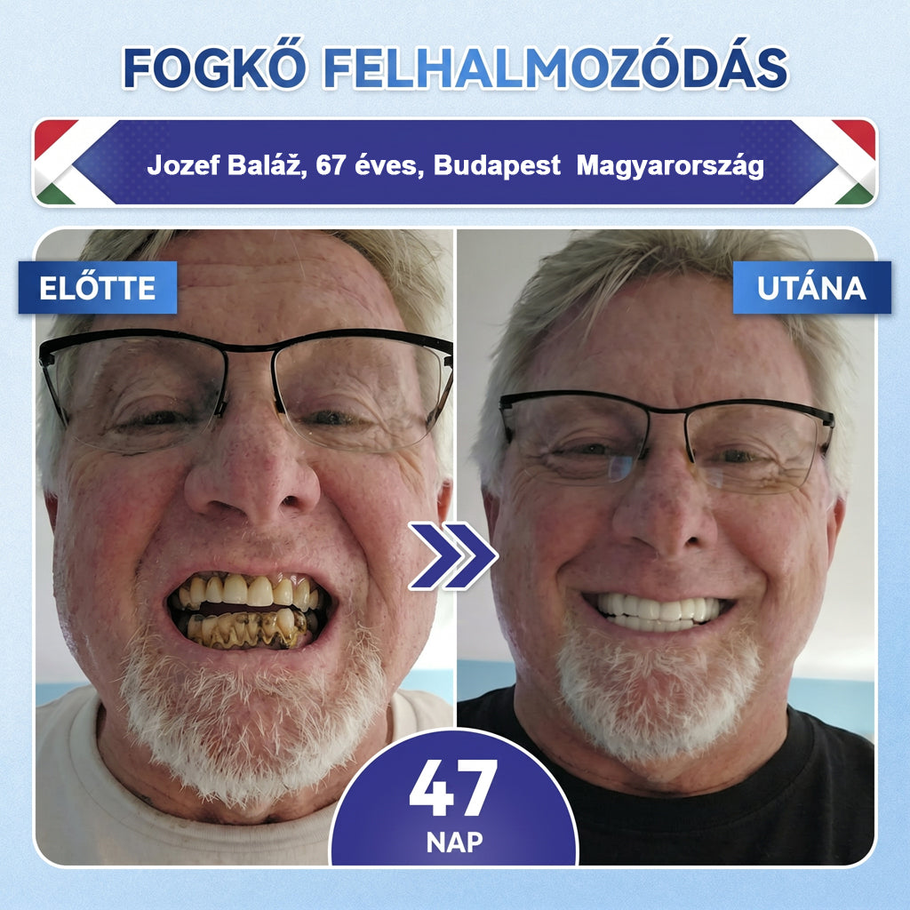 🦷HAJUEI® Tideglusib Fog & íny Javító mikrotűs tapasz | Fejlett őssejt-aktiváló fogcsíkok (újjáépíti a fogzománcot és a dentint • erősíti az ínyt • megszünteti a fogkövet és a szagokat • megállítja a fogérzékenységet)