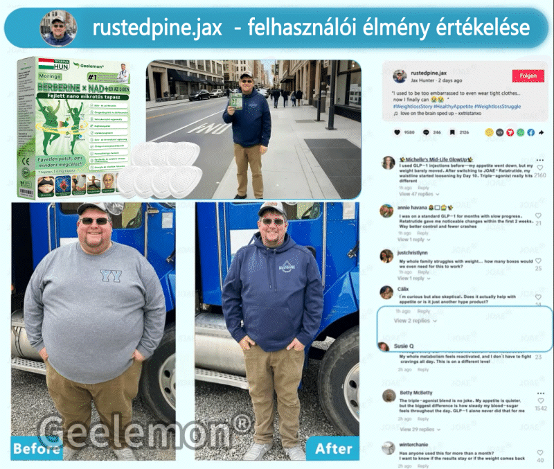 𝑮𝐞𝐞𝑳𝐞𝒎𝒐𝒏® 👩‍⚕️ 10 az 1-ben karcsúsító nano mikrotűs tapasz (Napi egyszeri használat, látható változások 7 napon belül) Elhízás, szív- és érrendszeri egészség, cukorbetegség