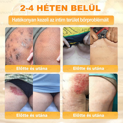 APKAPK®  Méhméreg krém a bőr megújítására 🐝 segít megoldani olyan bőrproblémákat, mint: ráncok, hegek, pigmentfoltok, striák, akné, pikkelysömör, ekcéma, bőrelváltozások, irritációk, gyulladások és egyéb bőrpanaszok.