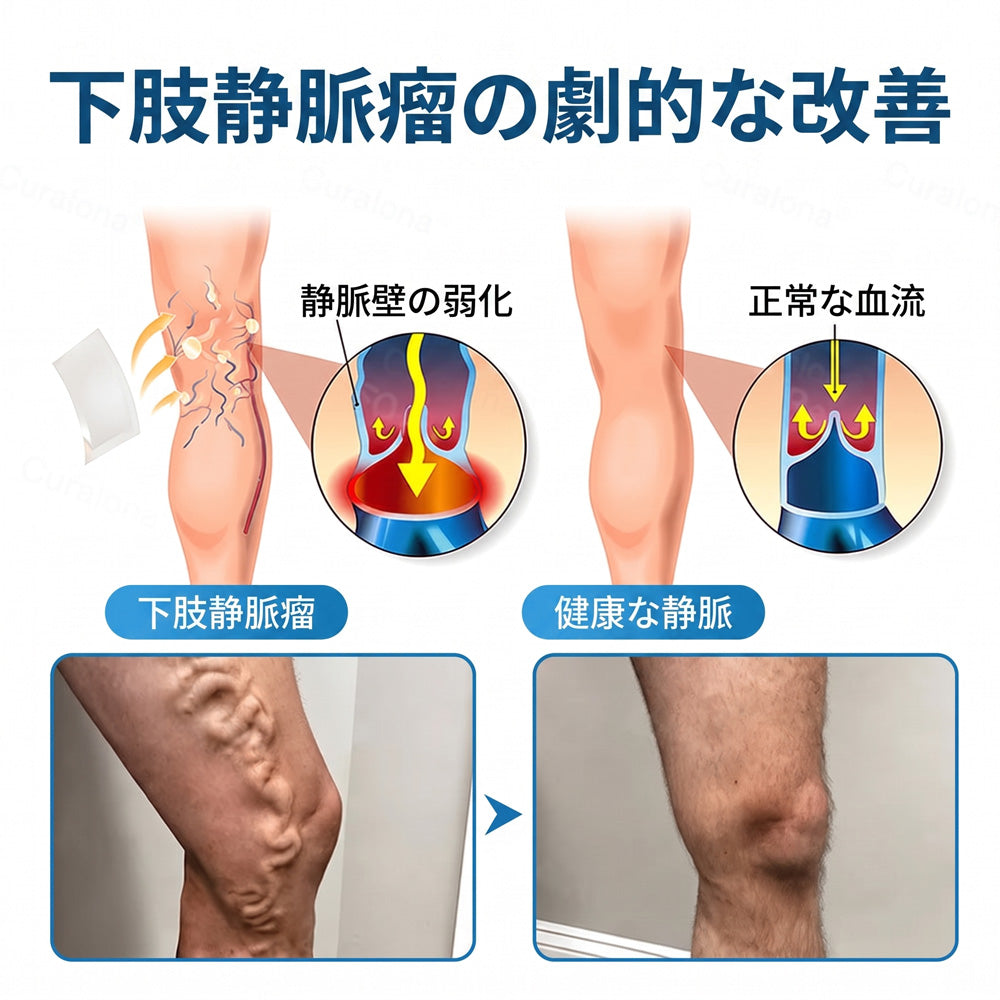 🇯🇵🏆✅️🏃 HAJUEI® VeinRepair マイクロニードルパッチロール ⚡ すばやくケア、効果を長くキープ