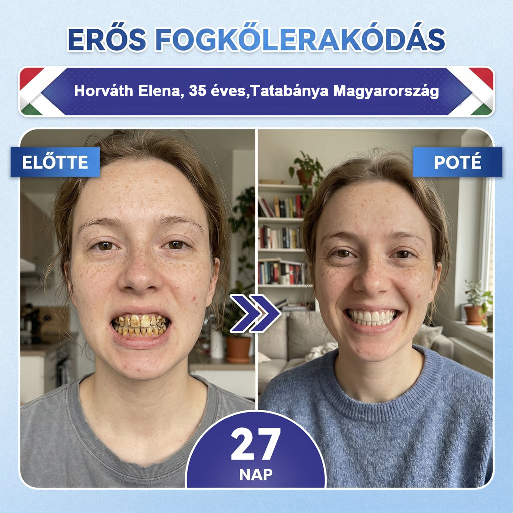 🦷HAJUEI® Tideglusib Fog & íny Javító mikrotűs tapasz | Fejlett őssejt-aktiváló fogcsíkok (újjáépíti a fogzománcot és a dentint • erősíti az ínyt • megszünteti a fogkövet és a szagokat • megállítja a fogérzékenységet)
