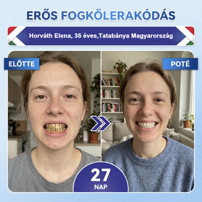 🦷HAJUEI® Tideglusib Fog & íny Javító mikrotűs tapasz | Fejlett őssejt-aktiváló fogcsíkok (újjáépíti a fogzománcot és a dentint • erősíti az ínyt • megszünteti a fogkövet és a szagokat • megállítja a fogérzékenységet)
