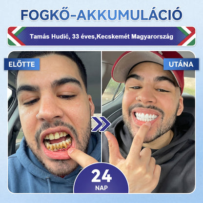 🦷HAJUEI® Tideglusib Fog & íny Javító mikrotűs tapasz | Fejlett őssejt-aktiváló fogcsíkok (újjáépíti a fogzománcot és a dentint • erősíti az ínyt • megszünteti a fogkövet és a szagokat • megállítja a fogérzékenységet)
