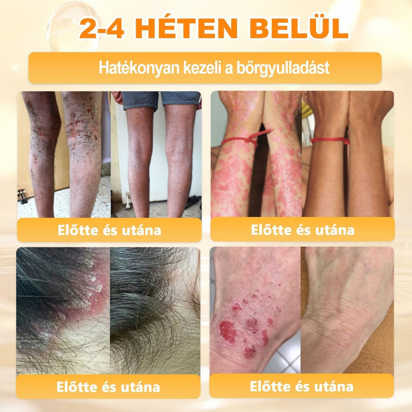 APKAPK®  Méhméreg krém a bőr megújítására 🐝 segít megoldani olyan bőrproblémákat, mint: ráncok, hegek, pigmentfoltok, striák, akné, pikkelysömör, ekcéma, bőrelváltozások, irritációk, gyulladások és egyéb bőrpanaszok.