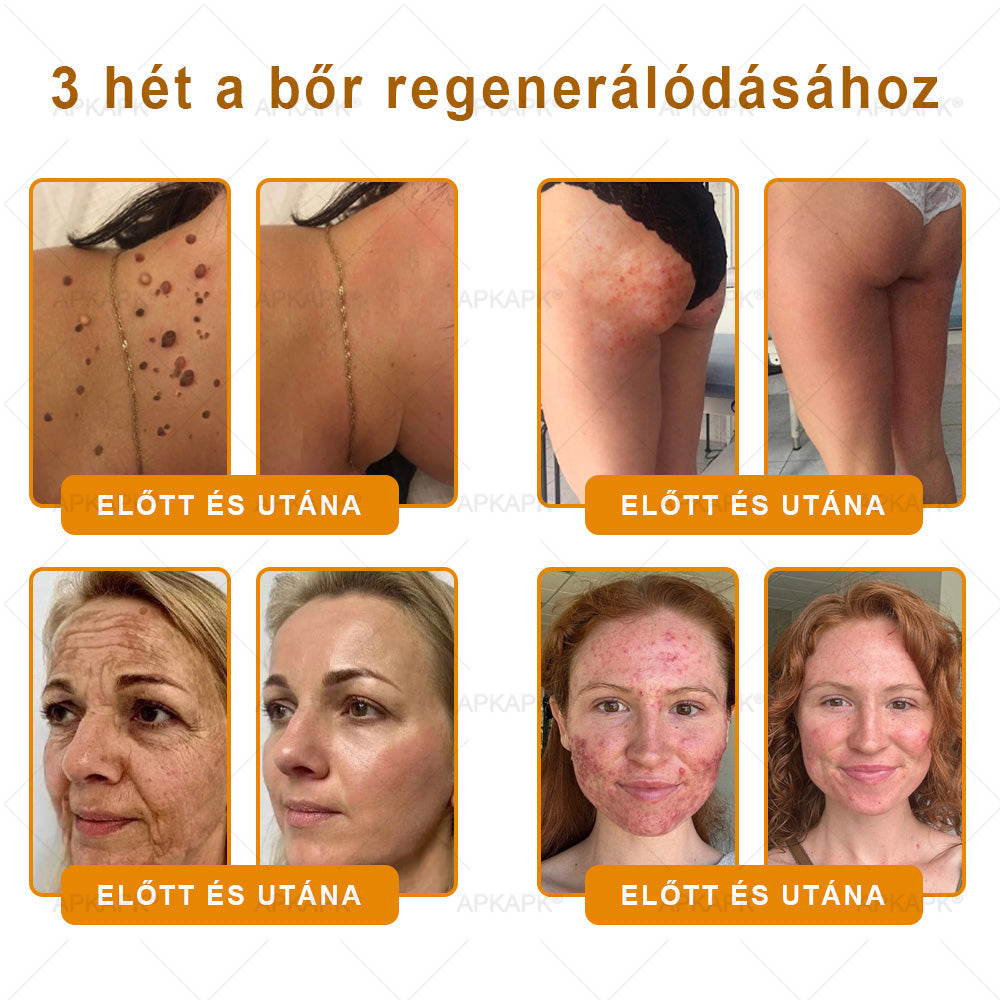 🎄Karácsonyi leárazás 🎄✨  ✨✨𝖠𝖯𝖪𝖠𝖯𝖪® méhméreges bőrmegújító krém