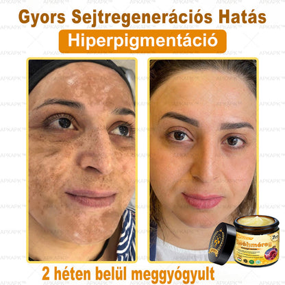 APKAPK®  Méhméreg krém a bőr megújítására 🐝 segít megoldani olyan bőrproblémákat, mint: ráncok, hegek, pigmentfoltok, striák, akné, pikkelysömör, ekcéma, bőrelváltozások, irritációk, gyulladások és egyéb bőrpanaszok.