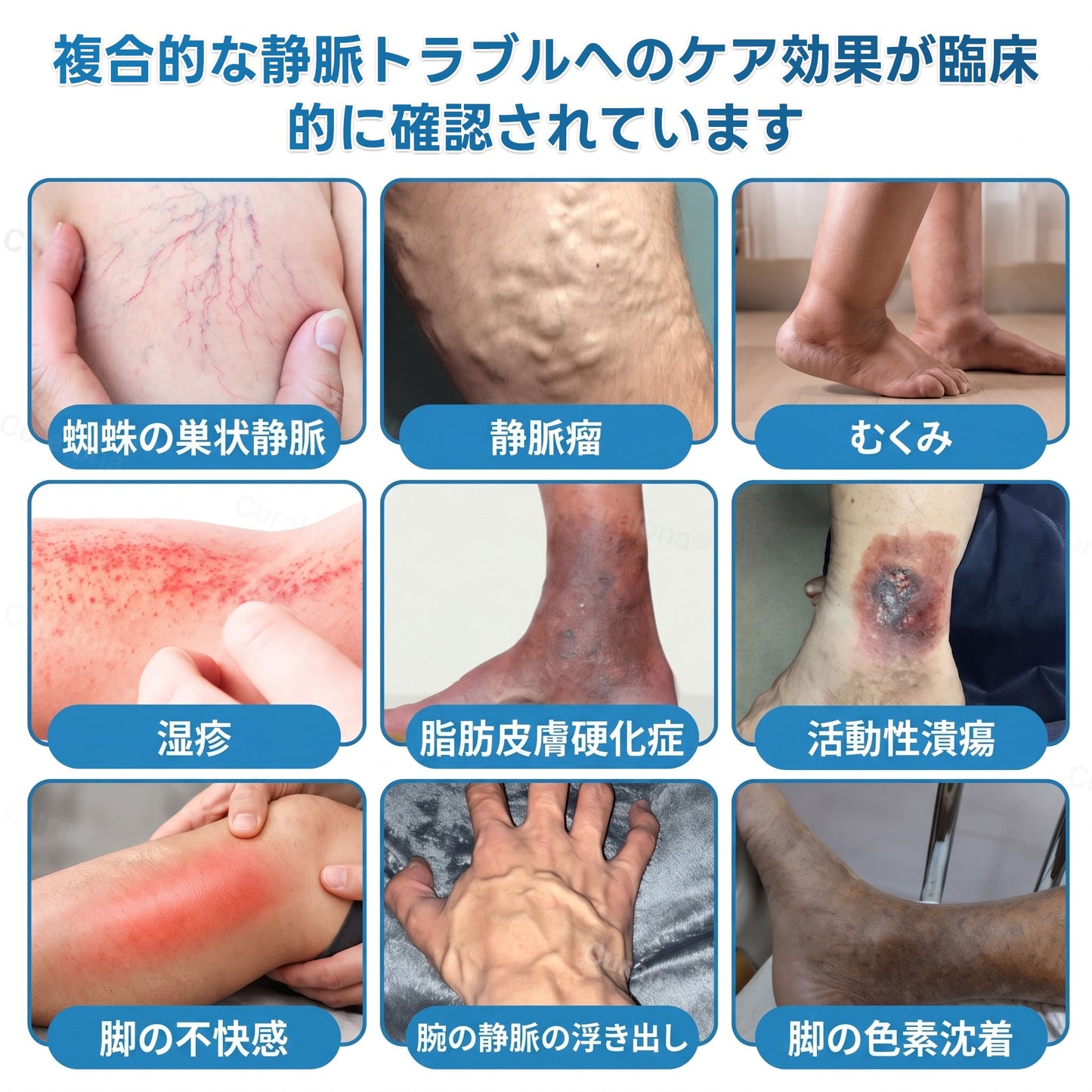 🇯🇵🏆✅️🏃 HAJUEI® VeinRepair マイクロニードルパッチロール ⚡ すばやくケア、効果を長くキープ