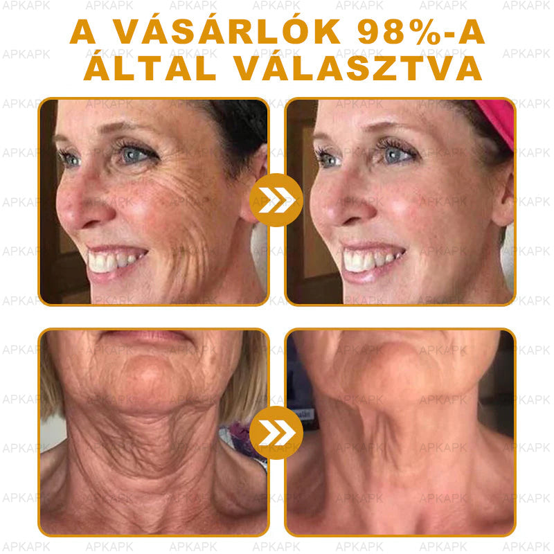 APKAPK®  Méhméreg krém a bőr megújítására 🐝 segít megoldani olyan bőrproblémákat, mint: ráncok, hegek, pigmentfoltok, striák, akné, pikkelysömör, ekcéma, bőrelváltozások, irritációk, gyulladások és egyéb bőrpanaszok.