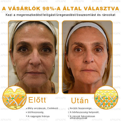 APKAPK®  Méhméreg krém a bőr megújítására 🐝 segít megoldani olyan bőrproblémákat, mint: ráncok, hegek, pigmentfoltok, striák, akné, pikkelysömör, ekcéma, bőrelváltozások, irritációk, gyulladások és egyéb bőrpanaszok.