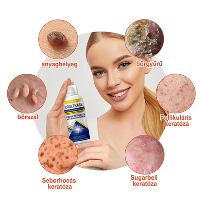 FFBSI® CoolErase Bőrregeneráló Spray (Szemölcsök, Hólyagok, Ekcéma, Pikkelysömör, Bőrkinövések, Akne, Bőrcímkék, Hegek, Anyajegyek)