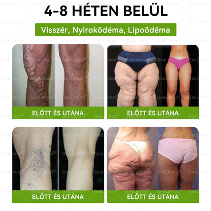 Magyar hivatalos bol 👩‍⚕️ 𝐆𝐞𝐞𝐋𝐞𝐦𝐨𝐧® 8 az 1-ben karcsúsító nano mikrotűs tapasz 🇭🇺 Napi egyszeri használat ✅ 7 napon belül látható eredmény – Alkalmas elhízás, szív- és érrendszeri problémák, cukorbetegség és ízületi problémák kezelésére