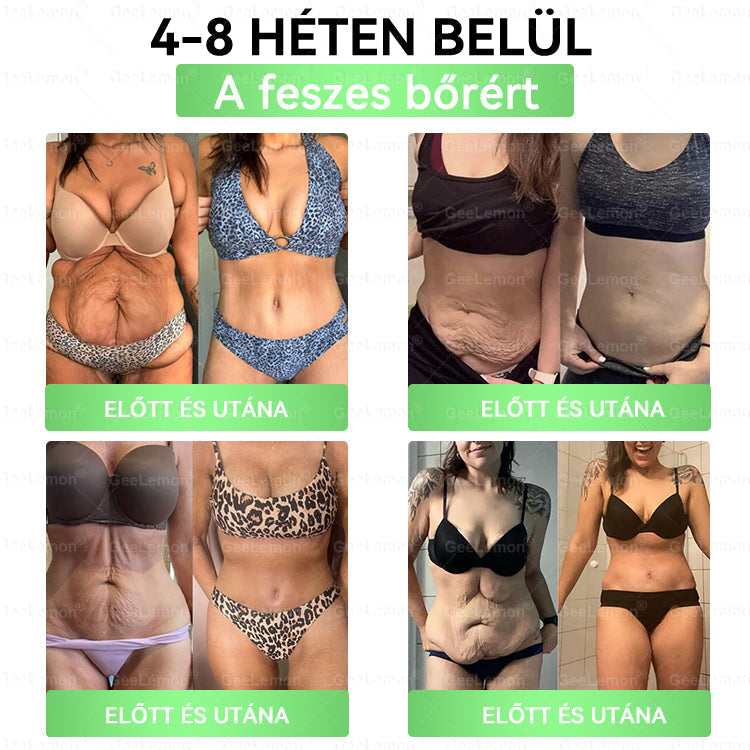 𝐆𝐞𝑒𝐿𝑒𝐦𝐨𝐧® 👩‍⚕️ Glumasetide 8 az 1-ben Karcsú és Egészséges Nano Mikrotűs Tapasz